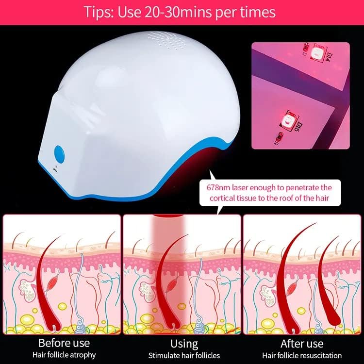 Image of AS-Biomeds LH80 Laser Helmet: Advanced Hair Growth System for Effective Hair Loss Therapy