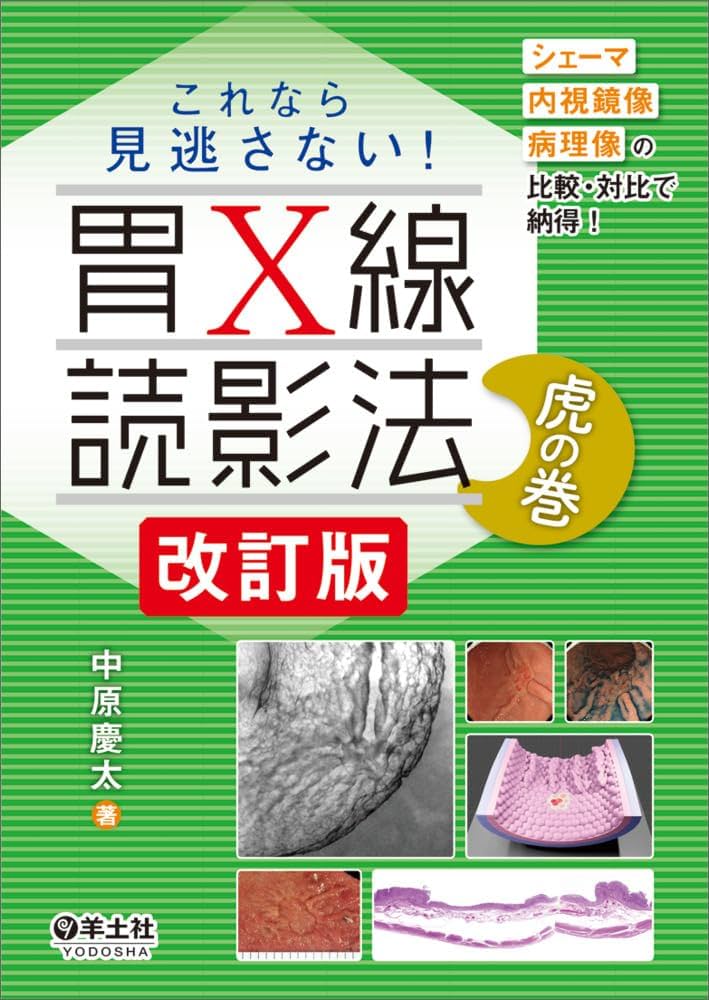 胃X線診断の考え方と進め方　胃X線読影の基本と実際 胃X線診断の考え方と進め方 | 裕司, 吉田, 平三郎, 市川 |本