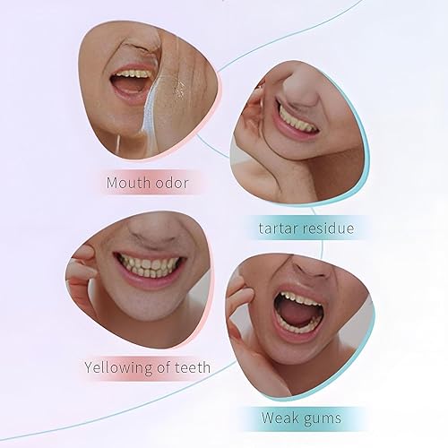 Miniatura 5 de La potente pasta dental blanqueadora de niacinamida puede eliminar las manchas de los dientes, limpiar los dientes y refrescar el aliento