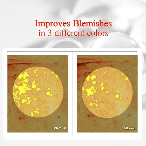 Miniatura 4 de PYUNKANG YUL Suero iluminador para el cuidado de manchas, mejor para iluminar la piel seca, hidratación las 24 horas, líneas finas, cuidado de