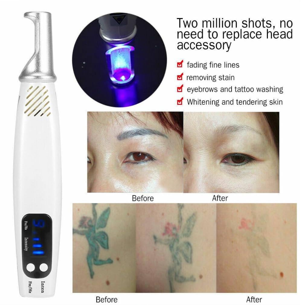 Stylo Picoseconde Pour Enlever Les Tatouages, Les Cicatrices, Les Grains De Beauté, Les Taches De Rousseur, Les Taches Brunes, Stylo De Suppression Des Acrochordons, Avec Lunettes,Red