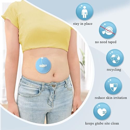 Miniatura 4 de Gtube - Fundas para botones, almohadillas para tubo de alimentación, soporte para tubo de nefrostomía, suministros de catéter de nefrostomía,