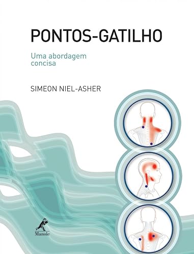 Pontos-gatilho: Uma abordagem concisa