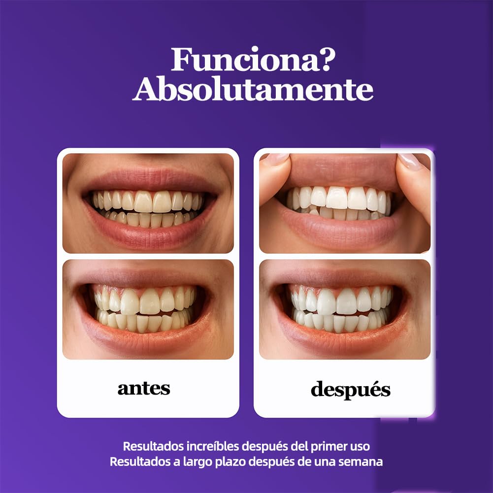 Dent Teeth Whitening Strips, Purple Whitening Strips Help Reduce Surface Stains, Easy Daily Oral Care Whitening Treatment for Adults Bright Smile Dental Care (3 Box)