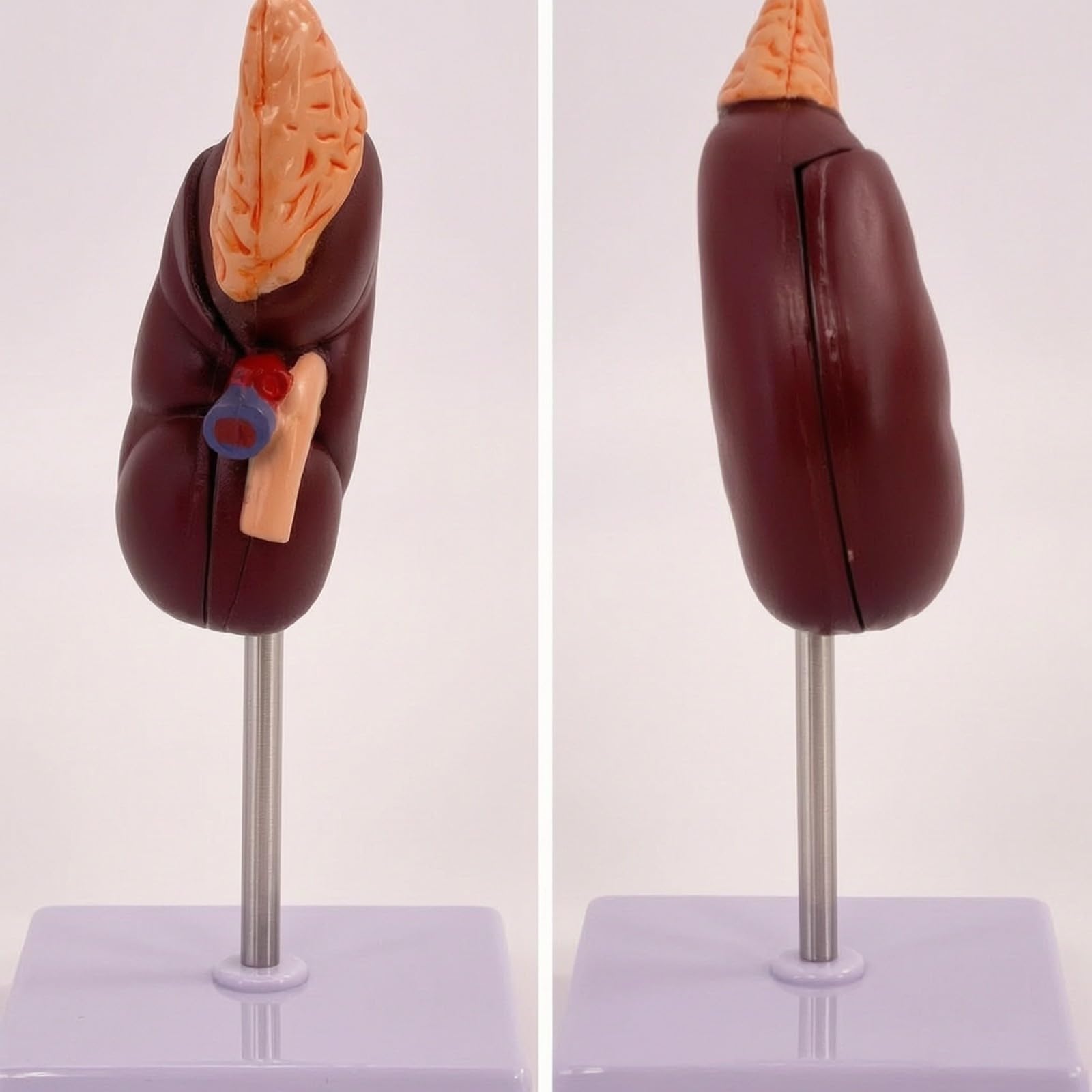 Riñón Educativo, 2X Riñón