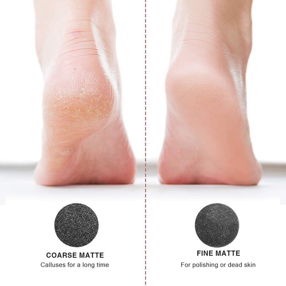 Aspirateur électrique pour callosités des Pieds - Outils de meulage de pédicure exfoliant - Réparation Automatique des Pieds, Facile à Utiliser - Traitement Professionnel des Peaux mortes/du