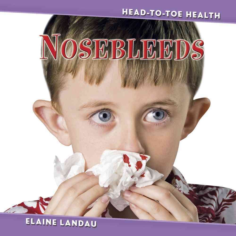 Buy Nosebleeds (Head to Toe Health) — BookShops.in