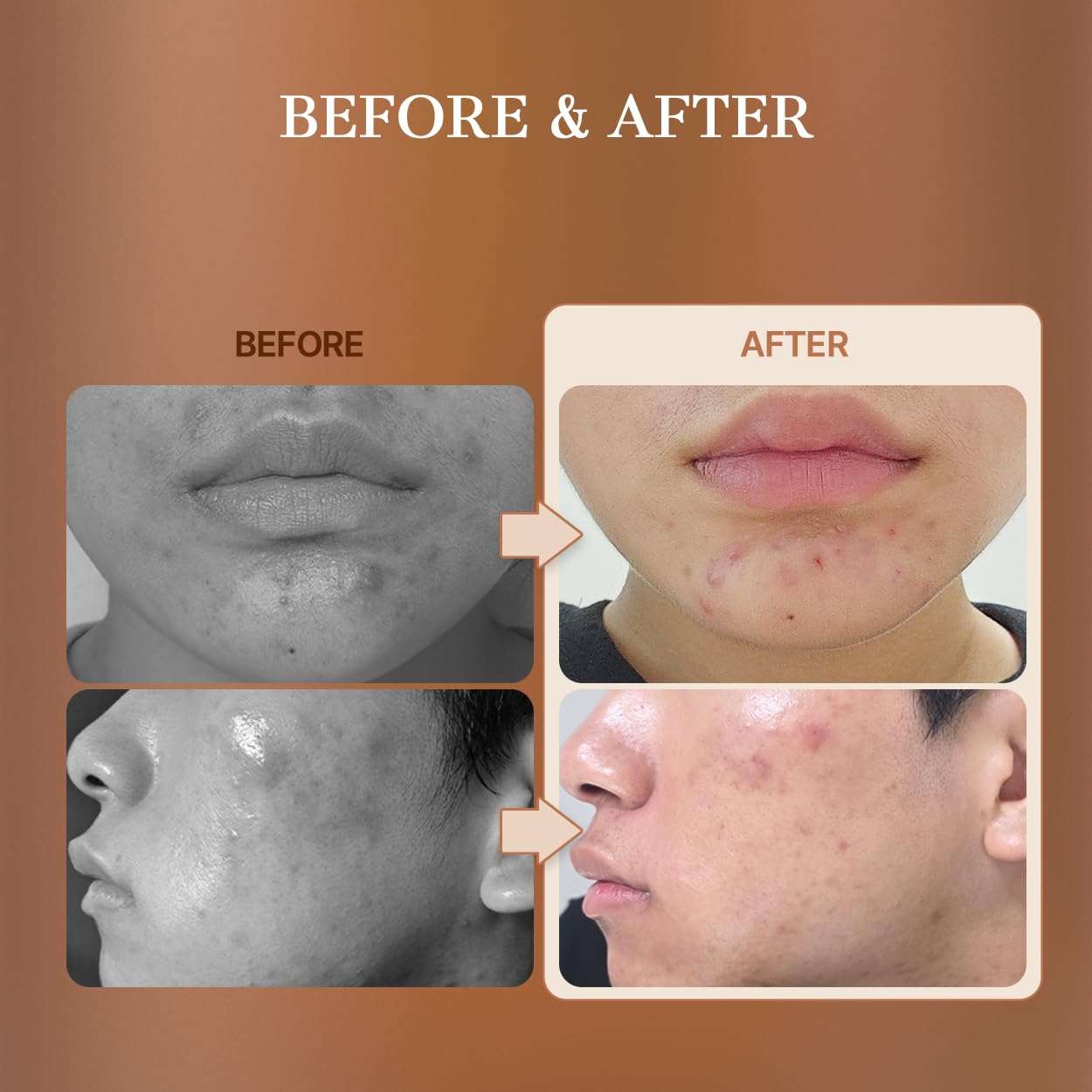 starlike Rosemary 68 Skin Biome Essence for Face | 3.38 Fl Oz (100 ml) | Micro-Bubble | 68% Concentrated Rosemary Extract | Niacinamide & Peptides | Balancing, Soothing & Calming | Korean Skincare - Image 6