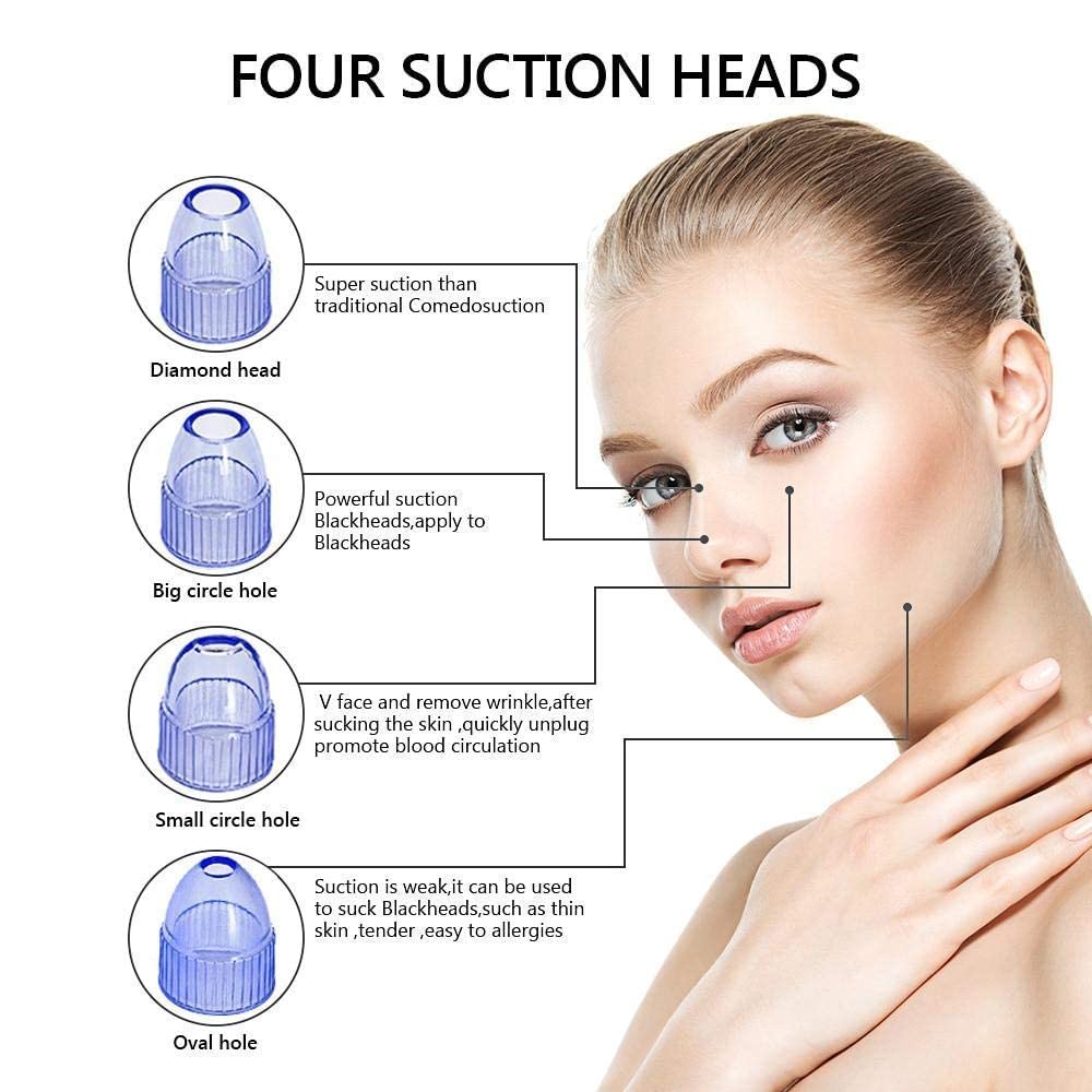 Revin Enterprise Derma Suction 4 in 1 Blackhead Whitehead Extractor Remover Device Acne Pimple Pore Cleaner Vacuum Suction Tool for Men and Women. (Derma Suction 4 in 1) 1