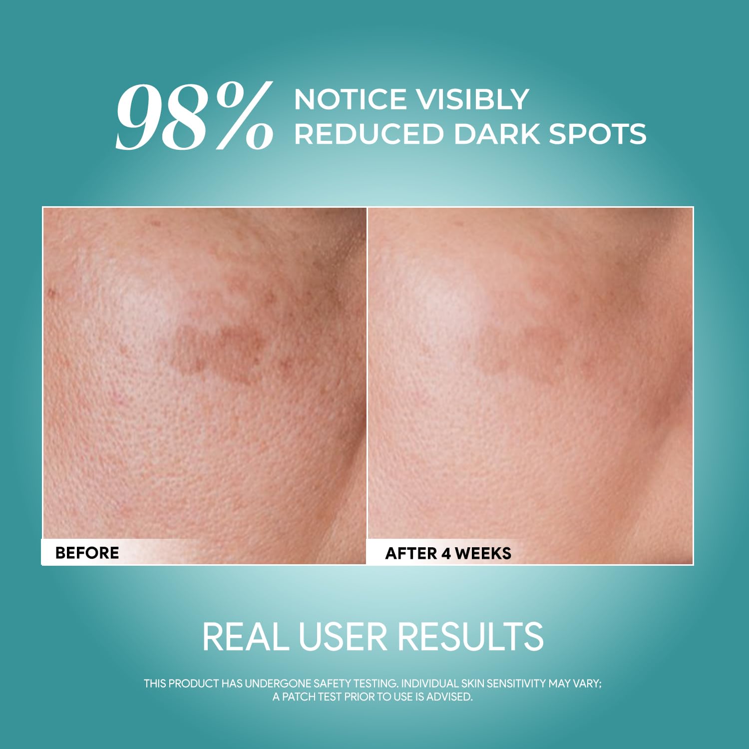 Advanced Youth Rejuvenating Serum with 10% Niacinamide + Arbutin – Brightening & Dark Spot Treatment – 50ml - Image 3