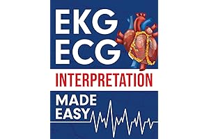EKG | ECG Interpretation Made Easy: A Comprehensive Illustrated Study Guide