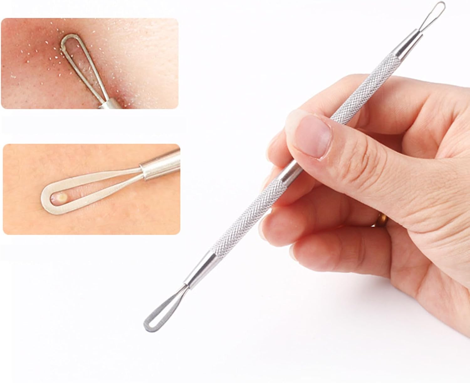 4 Pcs Silver Stainless Steel Blackhead Remover Tool – Pimple Acne Comedone Extractor for Nose Face Daily Skin Care​