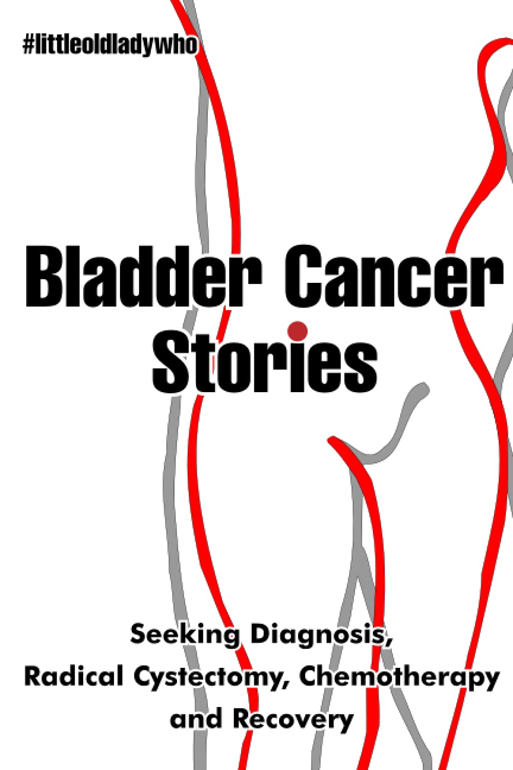 Bladder Cancer Stories: Seeking Diagnosis, Radical Cystectomy, Chemotherapy and Recovery