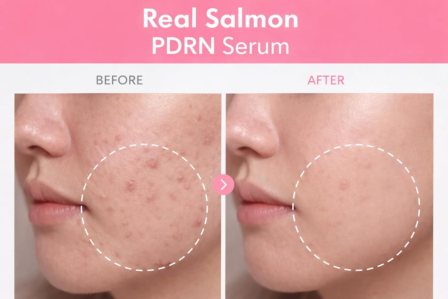 PDRN Peptide Repair Serum – High-Purity Salmon DNA, Peptide Complex, Niacinamide – Hydrating & Firming Facial Serum – Made in Korea - Image 3