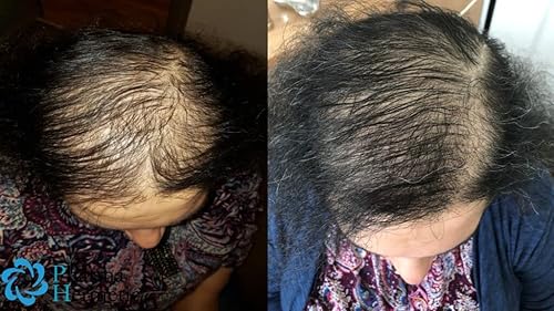 Miniatura 2 de Pharma Hermetic Phials (SP55) + Champú Anti Caída de Cabello – Sin sulfato estimula el crecimiento del cabello, densidad del cabello, fortalece el