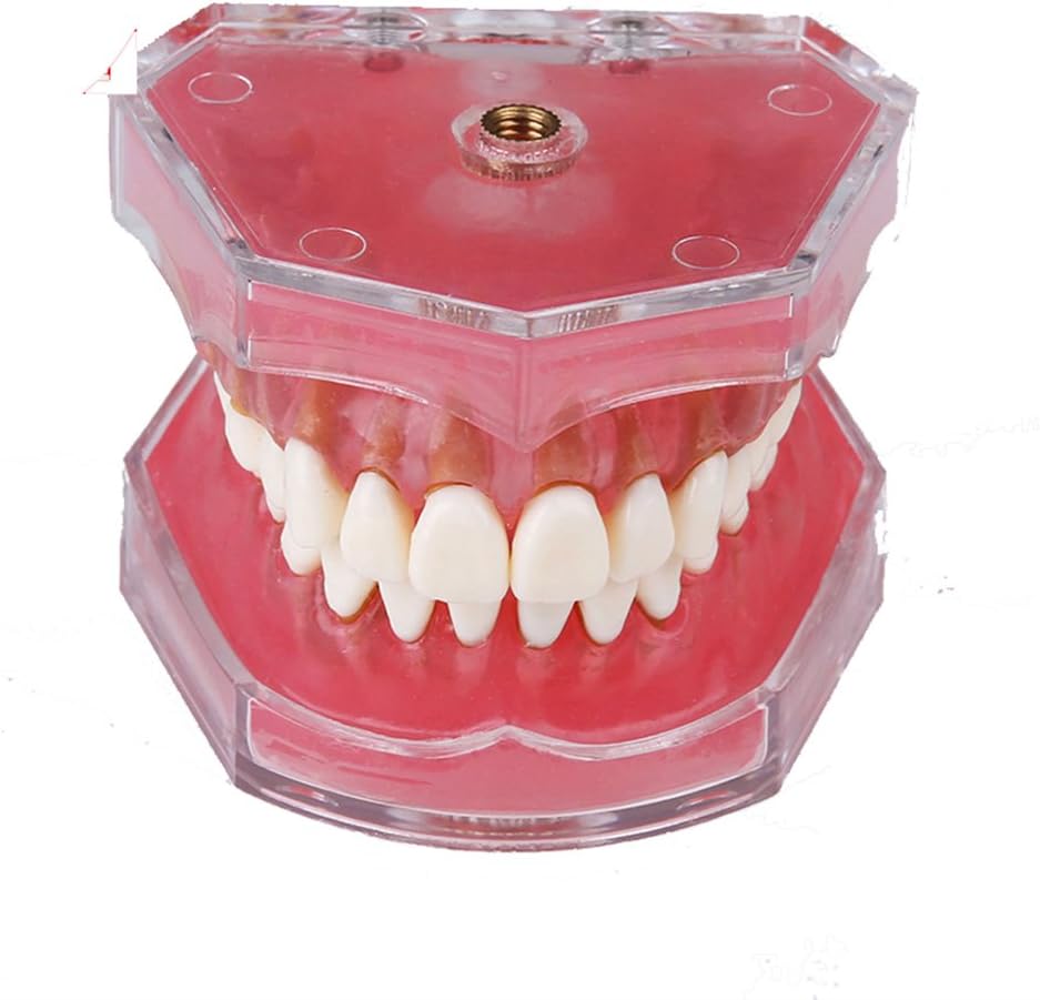 Dental standard orthodontic plastic teeth model 4004 with 28 removeable teeth Soft gums