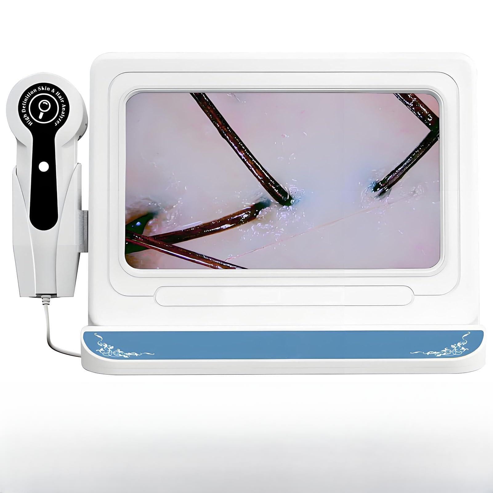 SHENGSHIYU Scalp Analyzer,Scalp Massager with Carry Case,50/200x Switchable Dual Lens,One-Click Capture,Hair Test,Follicle Detection,10mp HD Imaging,Rechargeable & Plug-In Dual Power