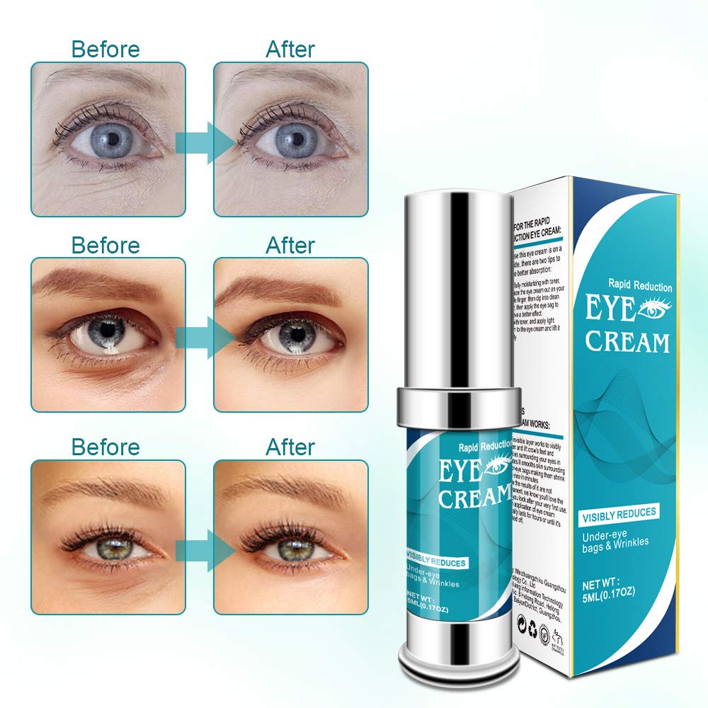 Rapid Reduction Eye Cream-Kinbeau Anti-Aging Eye Cream for Under-Eye Bags Treatment,Instant Results within 120 Seconds,Eye Cream for Dark Circles and Puffiness,Wrinkles (5 ml)