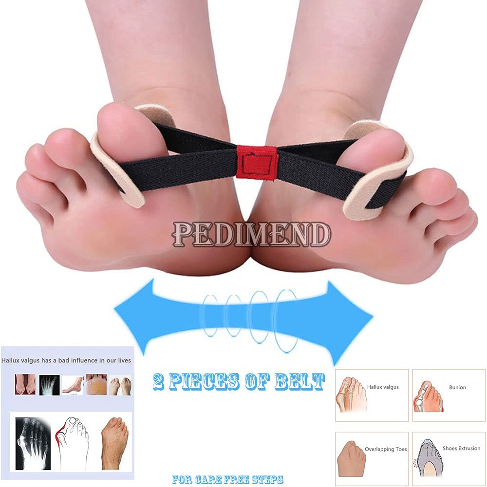 Pedimend alluce valgo correzione prevenzione dei piedi cintura supporto (pezzi) – alleviare il pollice ceppotoe separatore alluce valgoSetaccio Foot Care bracerestore Natural Big Toe