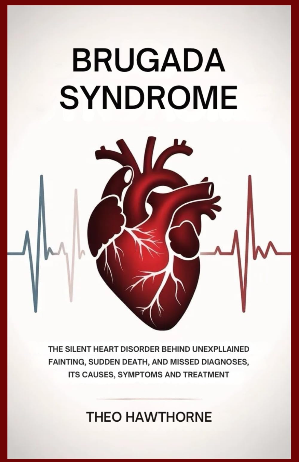 Brugada Syndrome: The Silent Heart Disorder Behind Unexplained Fainting, Sudden Death, and Missed Diagnoses: Its Causes, Symptoms, and Treatment