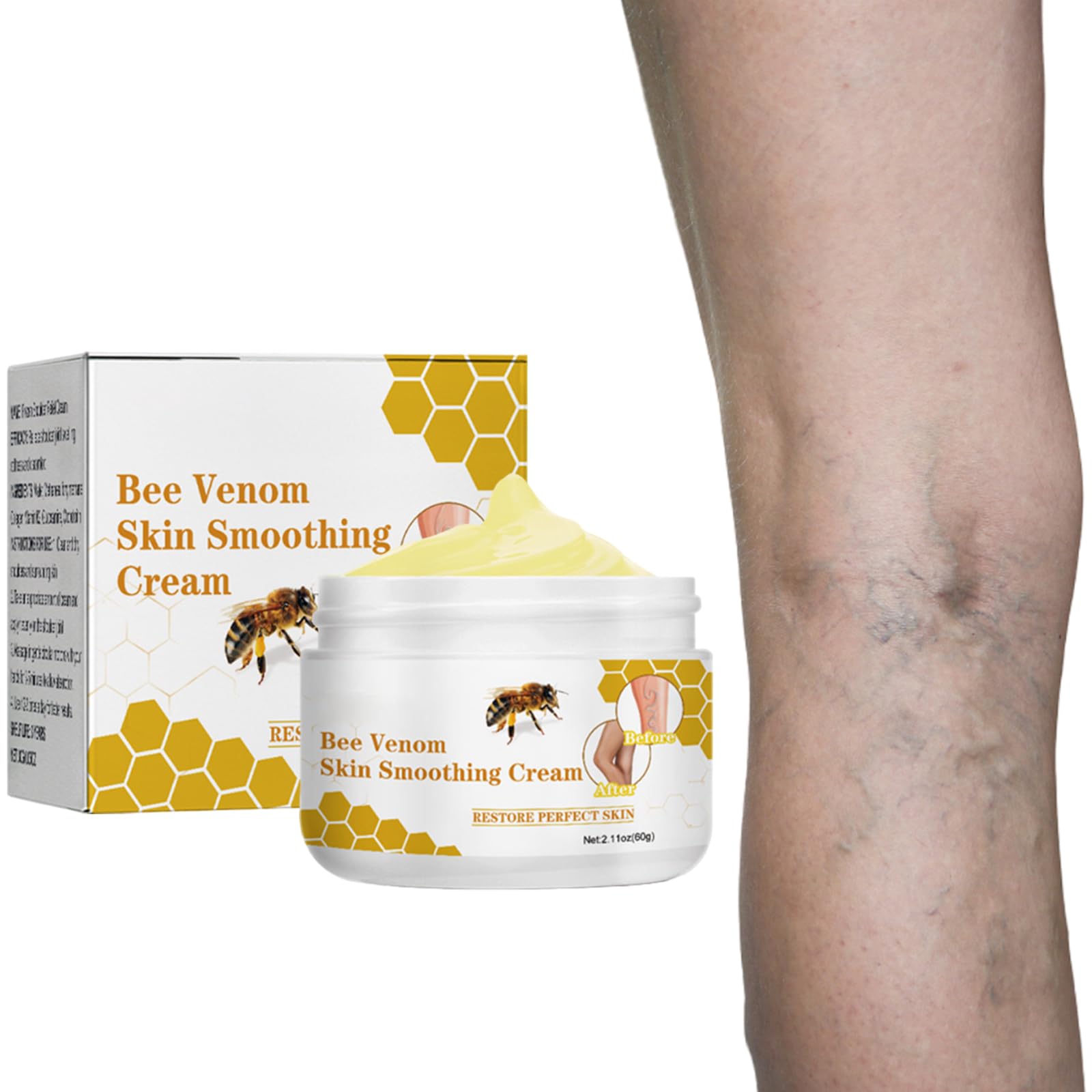 Crème pour Contre les Varices au Venin d'Abeille, Crème de Traitement des Varices au Venin d'abeille, Pommade de Récupération au Venin d'abeille pour les Jambes, Convient à Tous Les Types De Peau, 60g