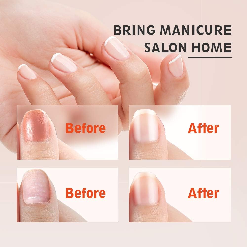 Before and after images of nails treated with the manicure set.