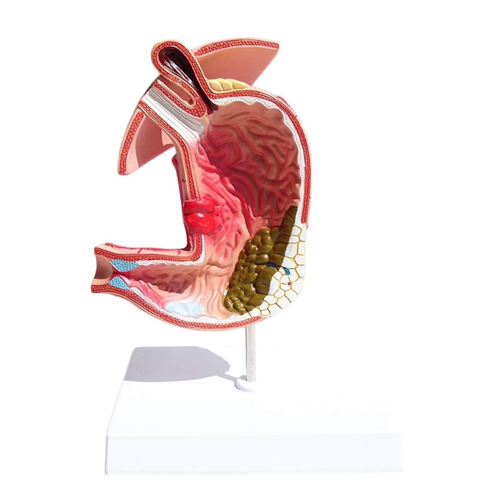 XINGLUOY Stomach disease demonstration model anatomy Human digestive system medical teaching