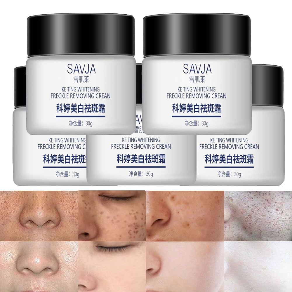1/2/3/5pcs Dark Spot Remover For Face,Spot Cream Hyperpigmentation Treatment,Dark Spot Corrector Cream Age Spot Remover For Face,Freckle Remover For Sun Spots,Pigmentation Treatment Skincare (5pcs)