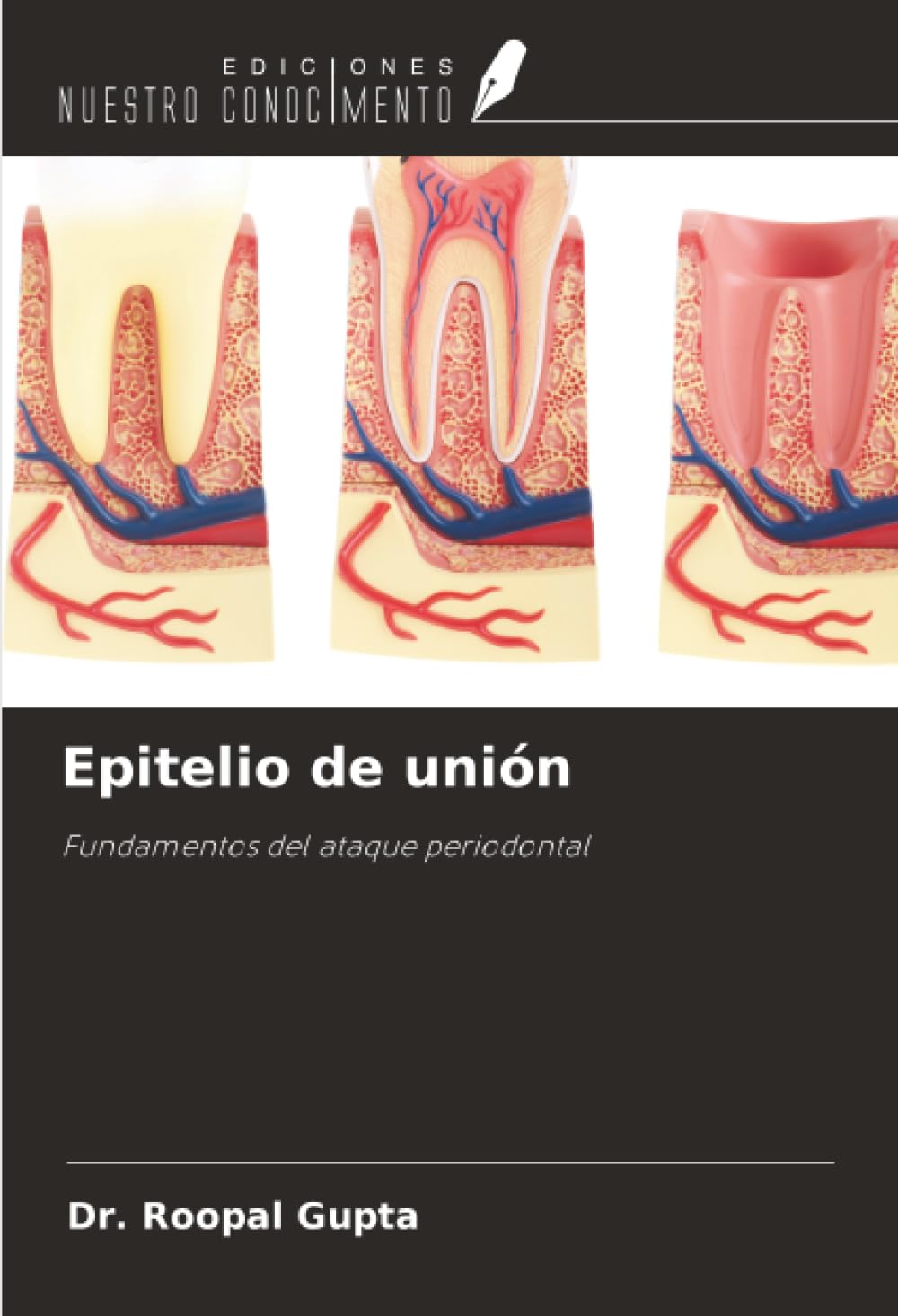 Epitelio de unión: Fundamentos del ataque periodontal