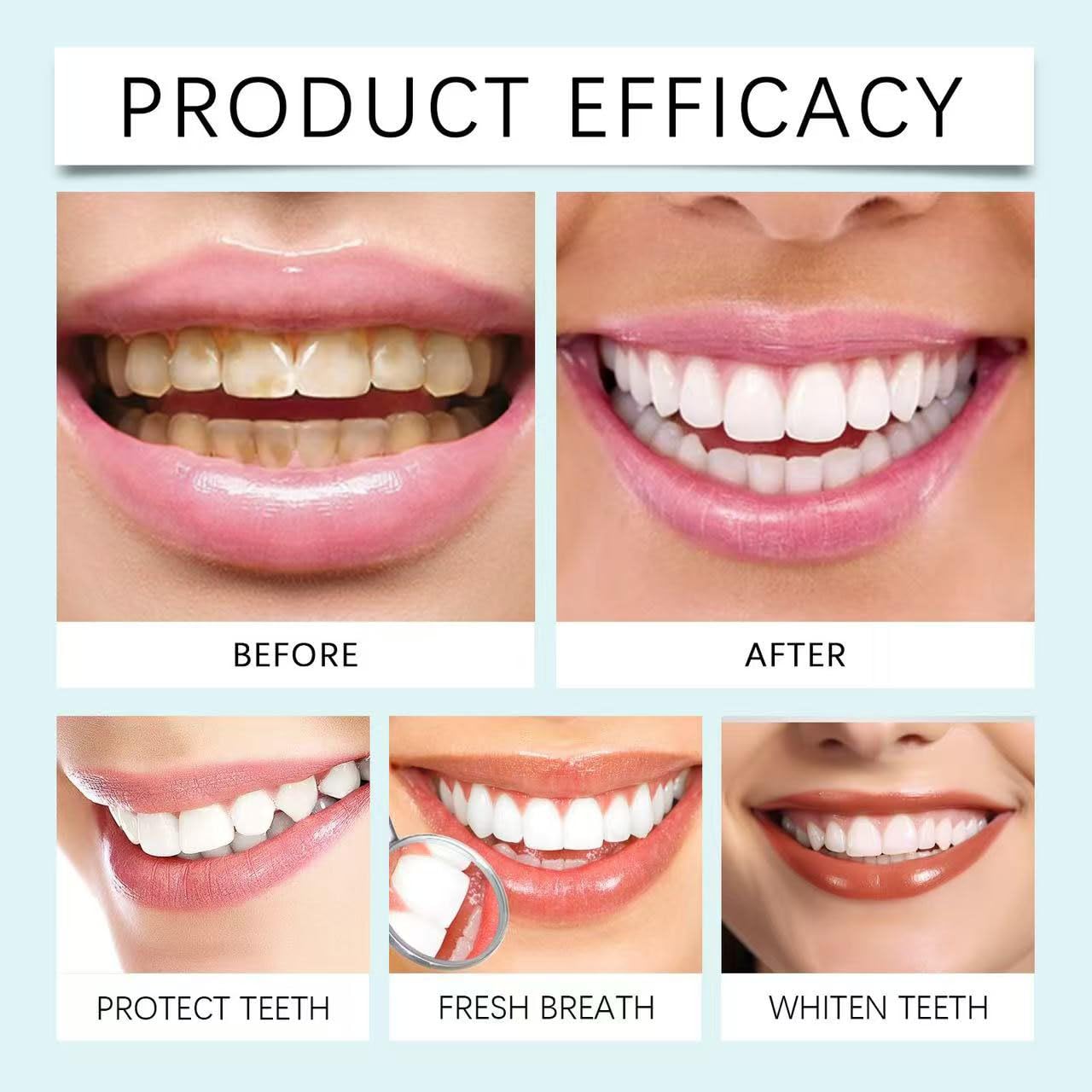 Dentifricio sbiancante alla niacinamide, gel sbiancante alla niacinamide per denti sensibili e alito fresco, dentifricio per rimozione macchie naturale, delicato, ripara e protegge (5 pezzi)
