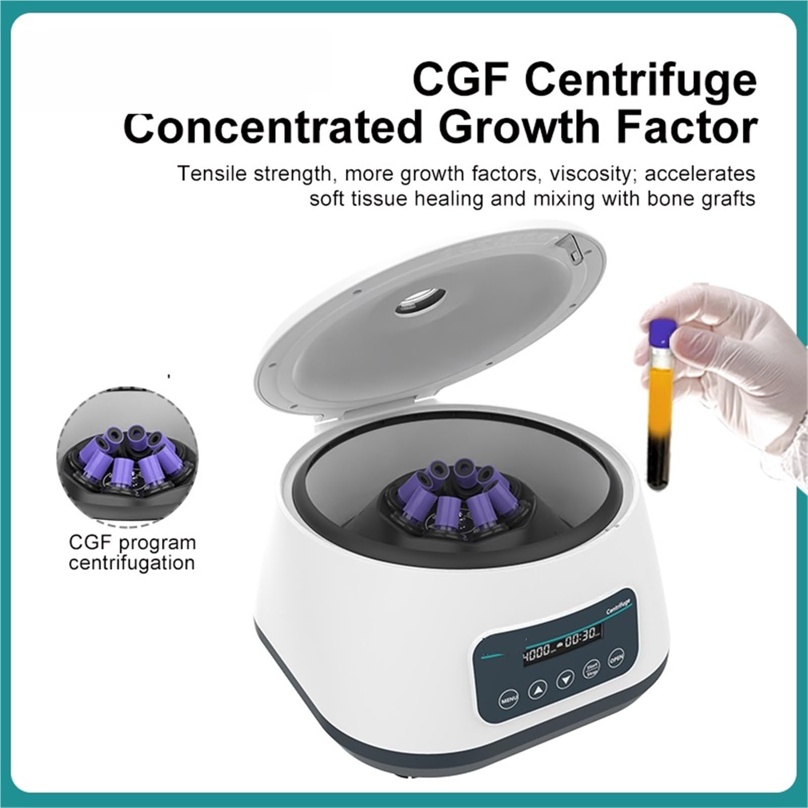 Centrífuga de sobremesa de laboratorio, Centrifugadora de laboratorio Cgf, máquina centrífuga, tubo de recolección de 5/10ml, tubo de centrífuga de 15ml, 1717xg, 4000rpm