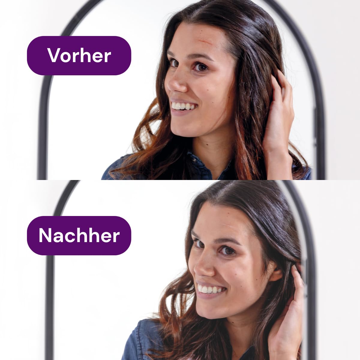 Silikon-Gel - Narbencreme - Reduziert Narben und Narbenbeschwerden - Tube 20 g