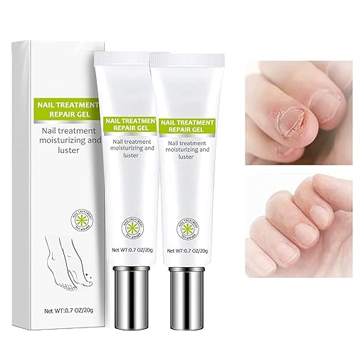 Gel de paroniquia de eliminación de NARC, gel de paroniquia de eliminación de uñas alemán (2 piezas)