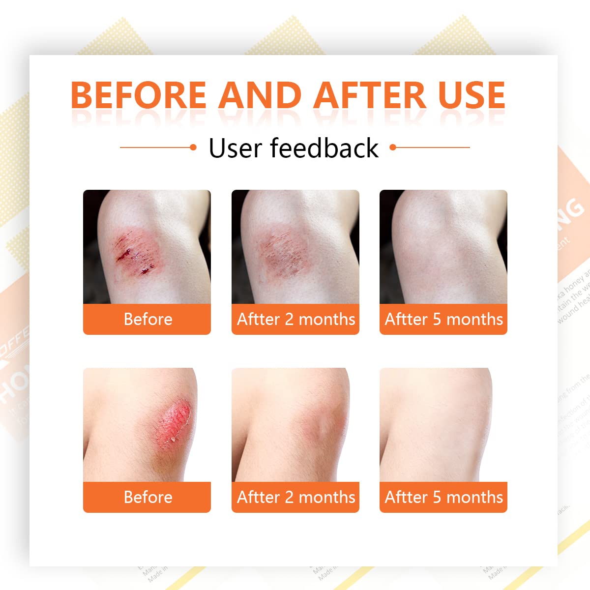 Buy Honey Wound Dressing, 4" X 4" Manuka Honey Wound Care, Medical