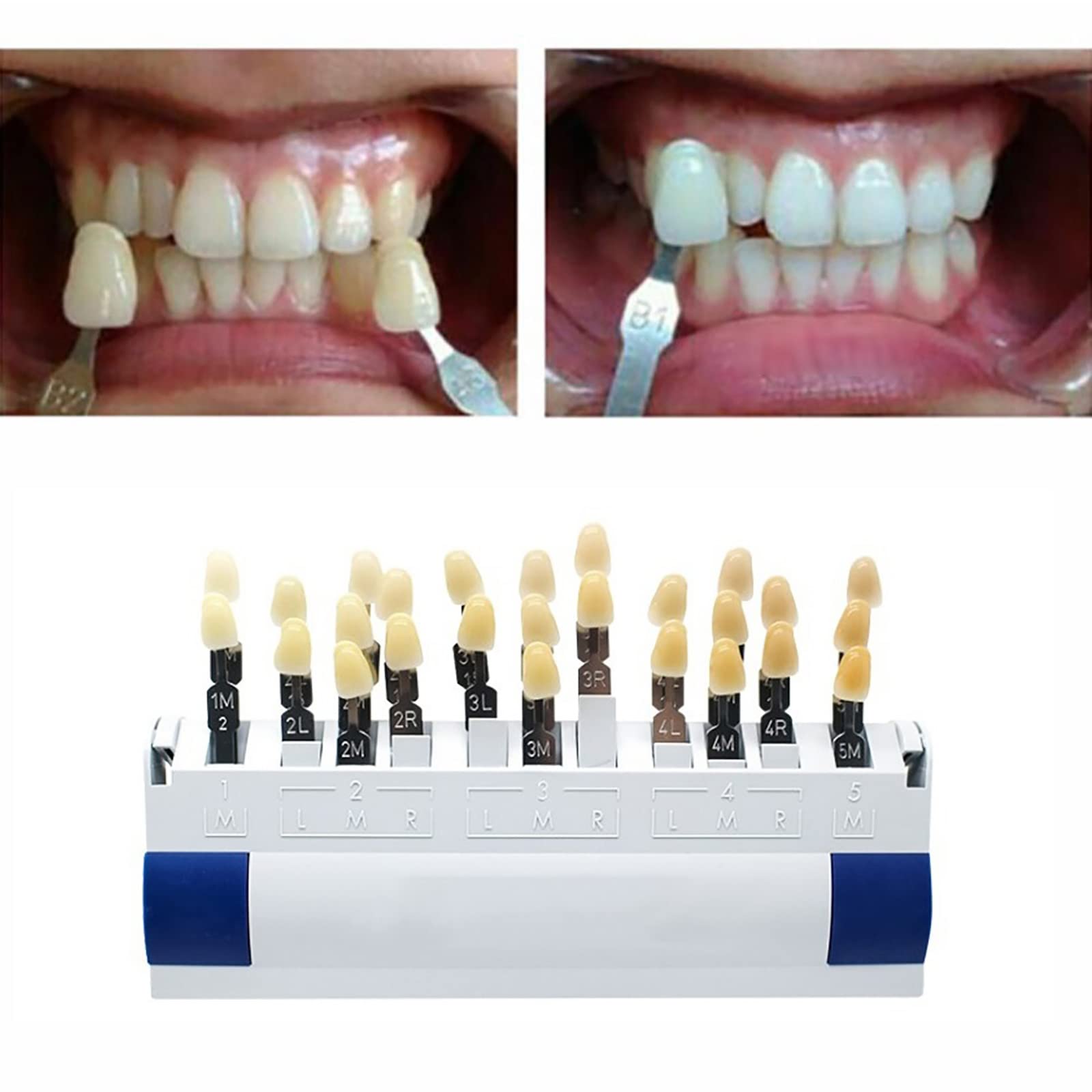 Buy OHYAS Tooth Shade Guide, Dental Material, 29 Color Shades Teeth