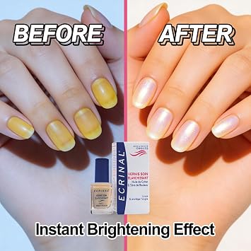 Vernis Soin Blanchissant - Ongles Jaunis Taches