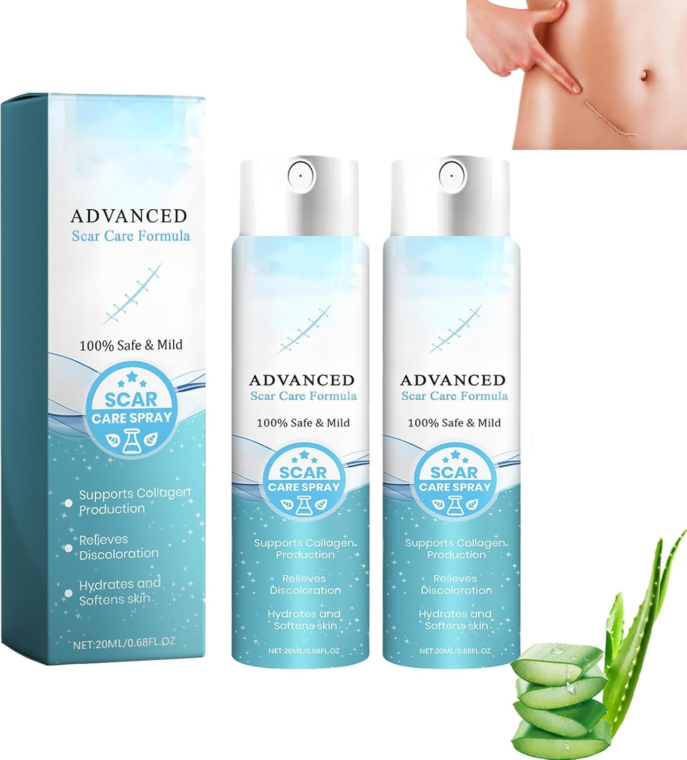 Azonee Scar Removal Medical Grade Scar Spray, Scar Removal Spray, Advanced Scar Treatment, Advanced Scar Gel, Suitable for All Types of Scars (2Pcs)