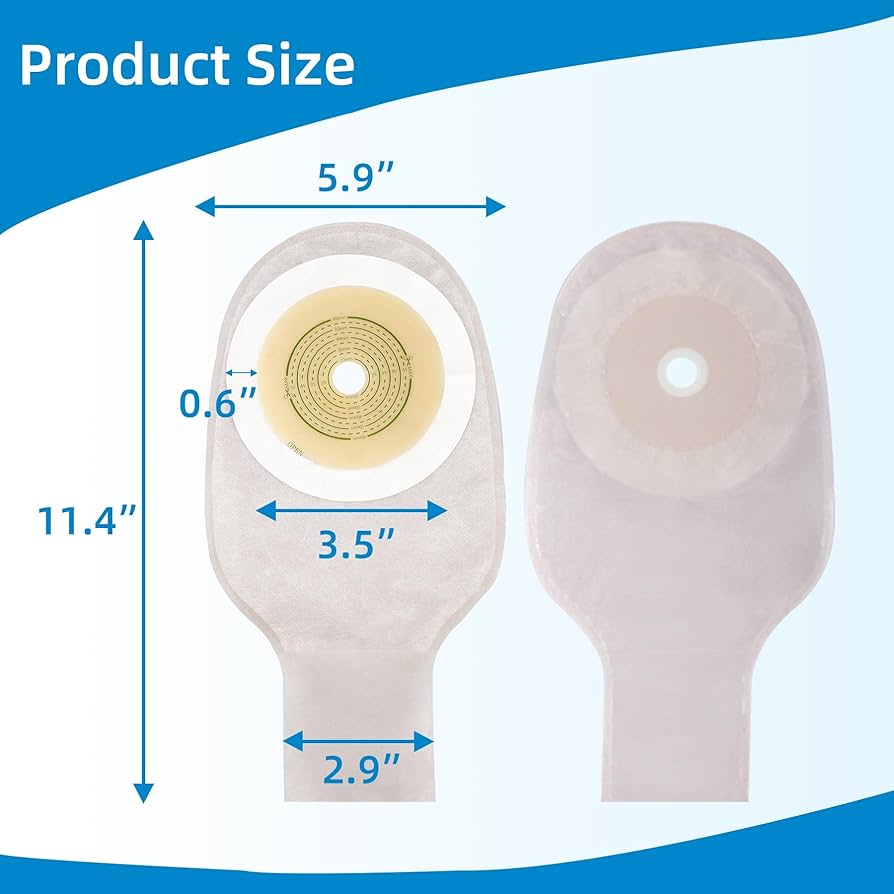 Details 149+ different types of colostomy bags latest kidsdream.edu.vn