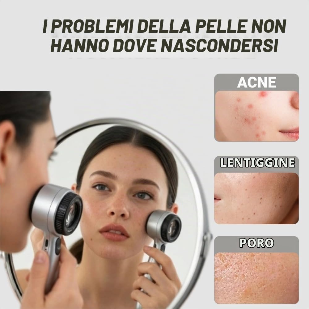 Dermatoscopio portatile, 4 modalità di illuminazione e lente ad alta chiarezza per la pelle, ricaricabile con ingrandimento 30x, dermatoscopio tascabile