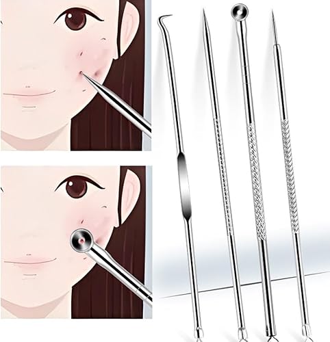 Miniatura 5 de Kit de pinzas para eliminar puntos negros, pinzas ultrafinas, extractor de manchas de puntos negros, aguja de acné, limpiador facial, herramienta