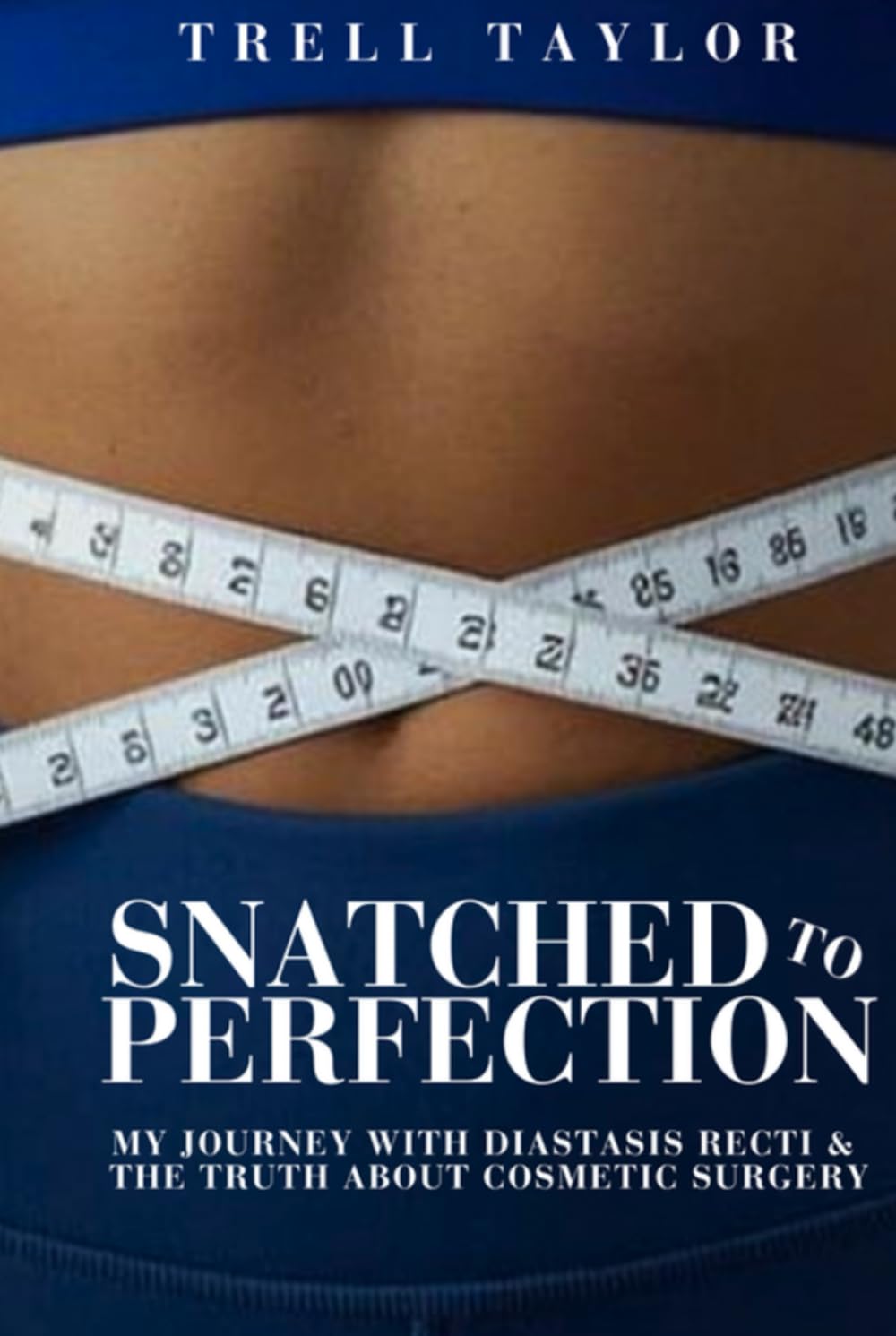 Snatched to Perfection: My Journey with Diastasis Recti & the Truth about Cosmetic Surgery