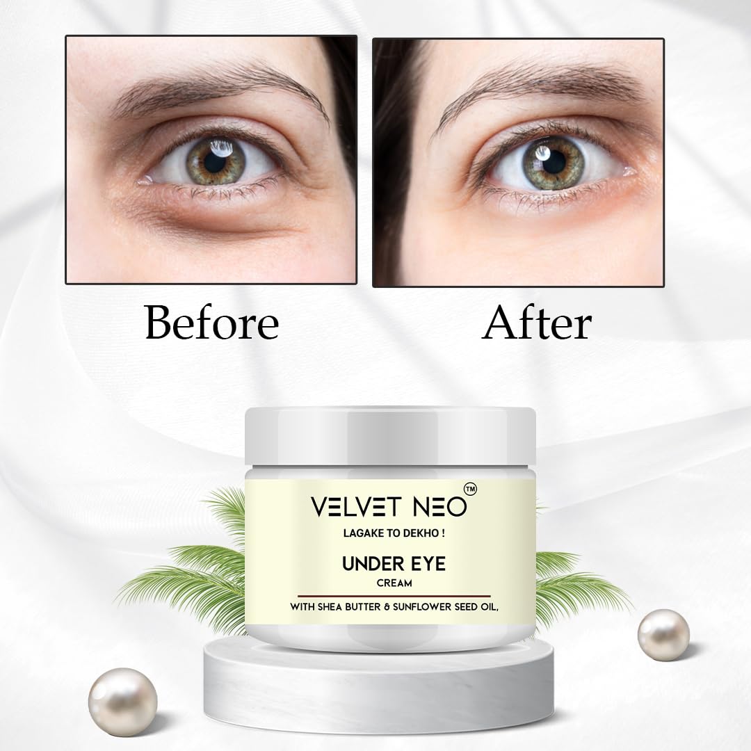 Under Eye Cream 50g | Hydrating Eye Cream with Shea Butter & Sunflower Seed Oil | Helps Reduce the Appearance of Dark Circles, Puffiness, Fine Lines & Wrinkles | For Men & Women — Amazon image 6