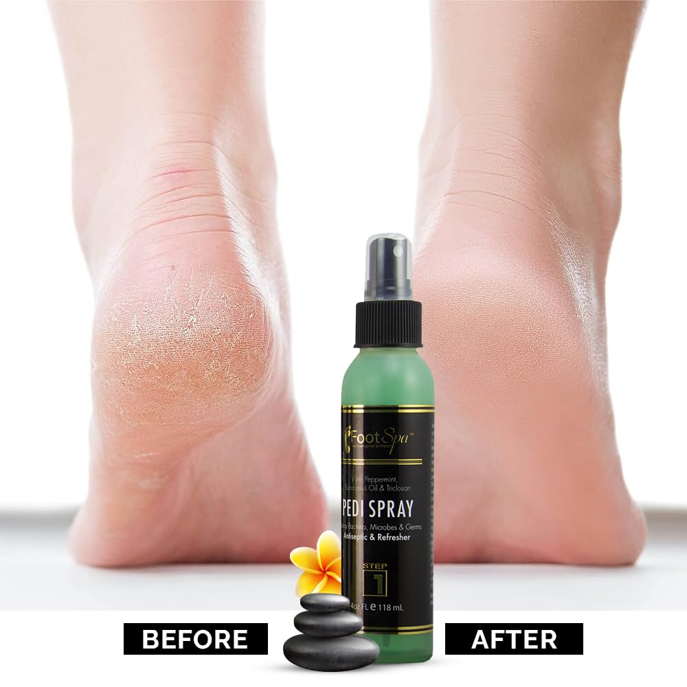 Pedi Spray Antiseptic, Mint & Eucalyptus - Refreshing Foot Care - 4 Ounces - Image 5