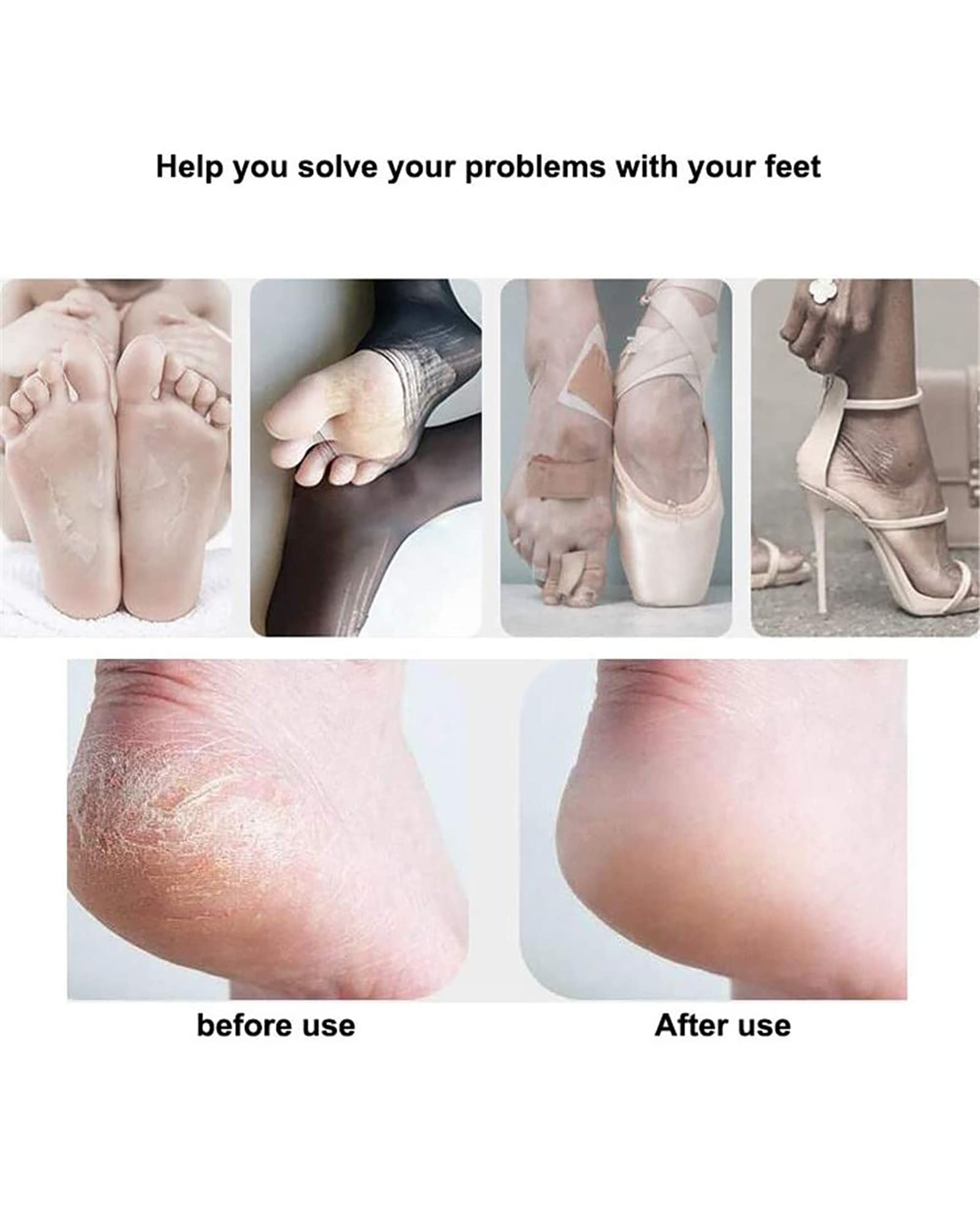 Lima eléctrica para pies, Juego de pedicura, removedor de Callos, Herramientas de pedicura, vacío Incorporado con 3 Rodillos, 2 velocidades y luz LED