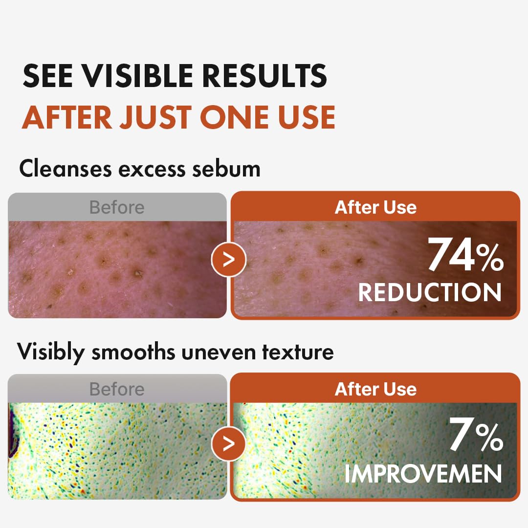 Hanskin BHA Pore Cleansing Oil, Gentle Blackhead Cleanser and Makeup Remover for Combination and Oily Skin, Korean Skincare [BHA/10.14 oz] - Image 4