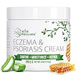 Wild Naturals Eczema & Psoriasis Cream for Dry, Itchy Skin - Eczema Relief for Adults & Kids - Moisturizing Psoriasis Cream with Manuka Honey