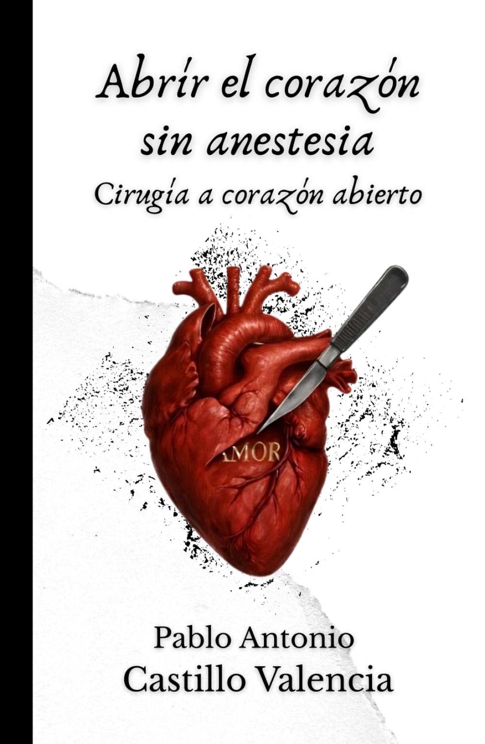 Abrir el corazón sin anestesia: Cirugía a corazón abierto