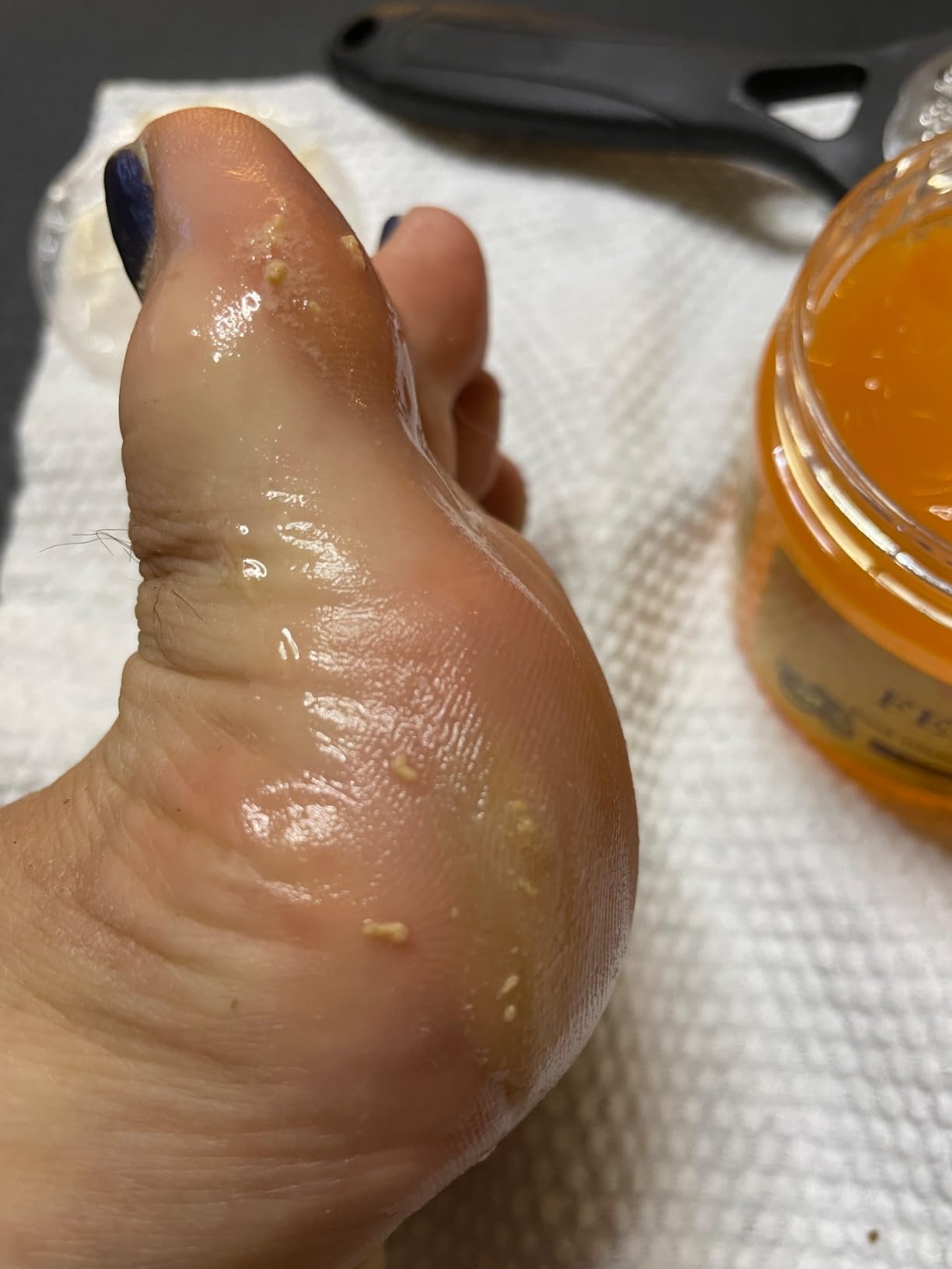 xiweioo Foot Callus Remover Gel Foot Files Kit Heel Foot Callus Remover Gel Exfoliator Dead Skin Remover Pedicure Foot Spa Products Home Pedicure Foot Spa Supplies for Rough, Dry, Cracked Skin
