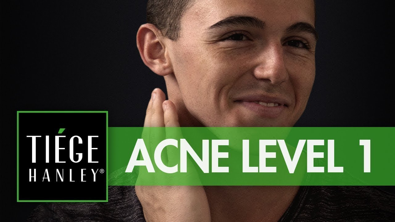 tiege hanley acne system