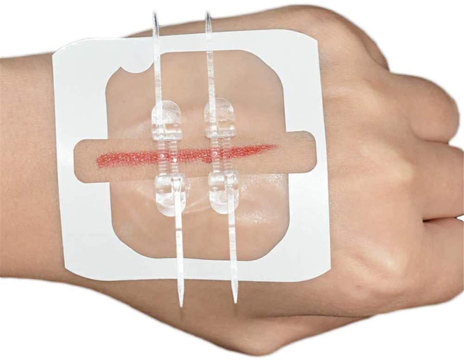 Buy BandAid, Zipper SutureFree Band Aid,Emergency Wound Closures